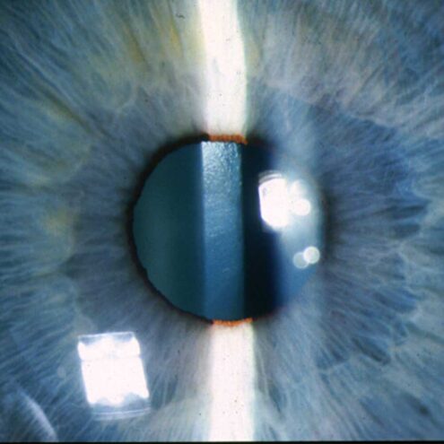 Makro fotografiel lidské rohovky - Lucie Stránská.